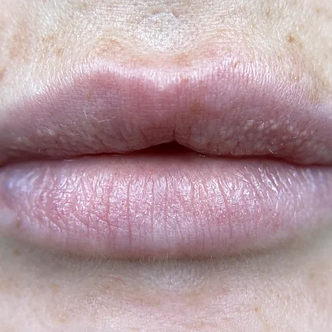 Before Lip Blush treatment